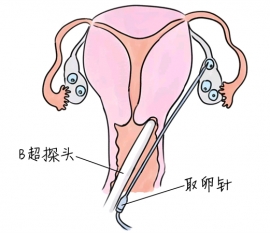 幼儿学画画，温州捐卵宝宝学画画，学画画的好处，如何学画画