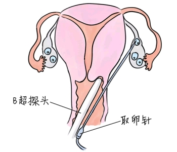 幼儿学画画，温州捐卵宝宝学画画，学画画的好处，如何学画画